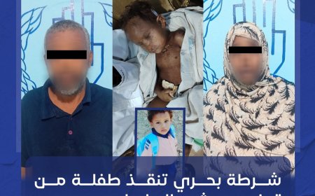 على يد خالتها وزوجها...إنقاذ طفلة من تعذيب وحشي بالسامراب