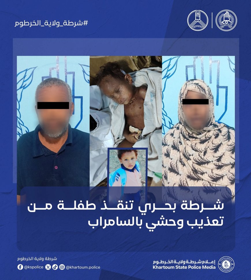 على يد خالتها وزوجها...إنقاذ طفلة من تعذيب وحشي بالسامراب